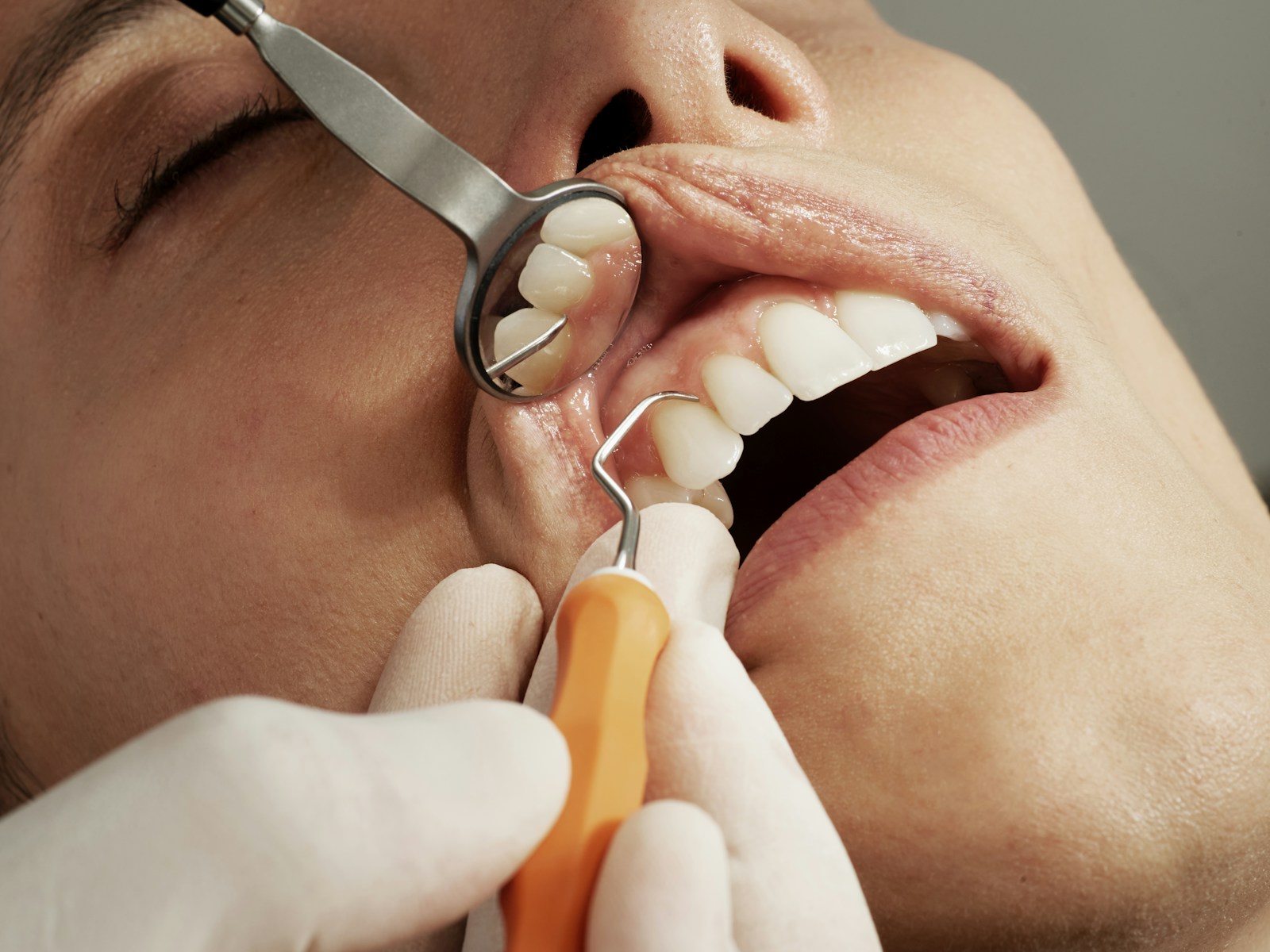 Patient receiving attentive dental care